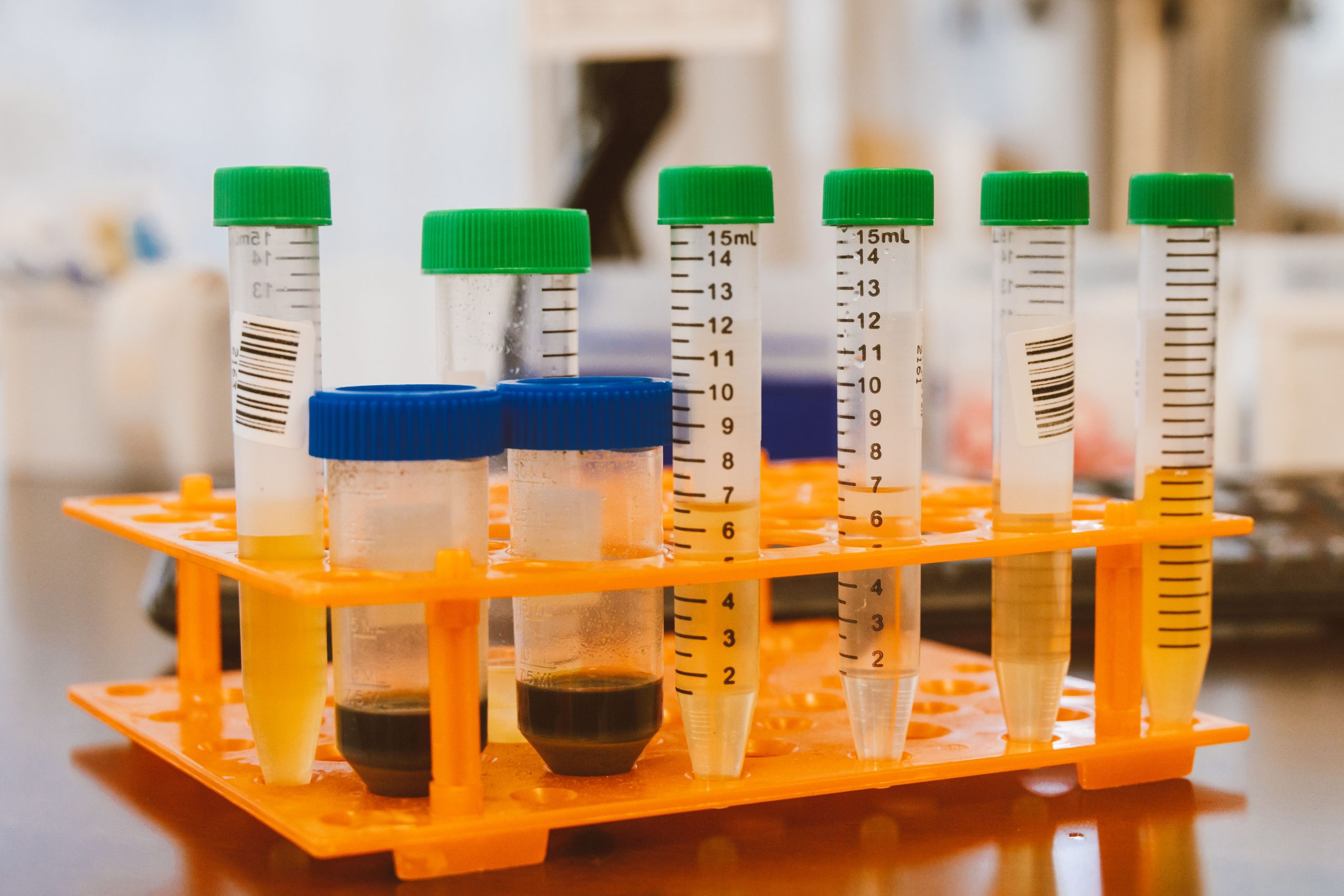Close-up of colorful test tubes in a laboratory setting, representing scientific experimentation.